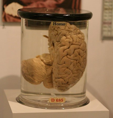 Cerebro de Babbage